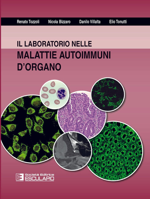 TOZZOLI BIZZARO VILLALTA TONUTTI - Il laboratorio nella malattie autoimmuni d'organo