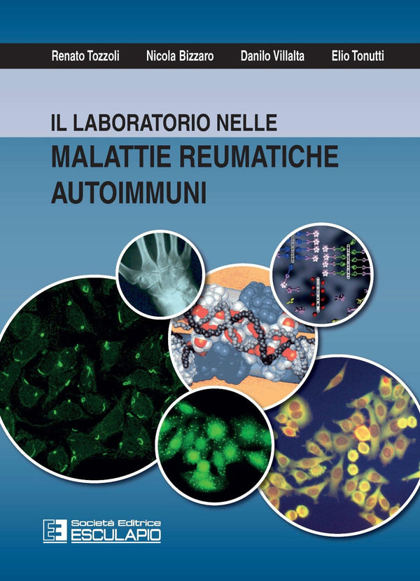 TOZZOLI BIZZARO VILLALTA TONUTTI - Il Laboratorio nelle malattie reumatiche autoimmuni